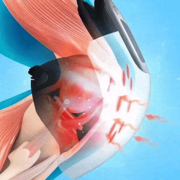 Smart Knee Physiotherapy Massager